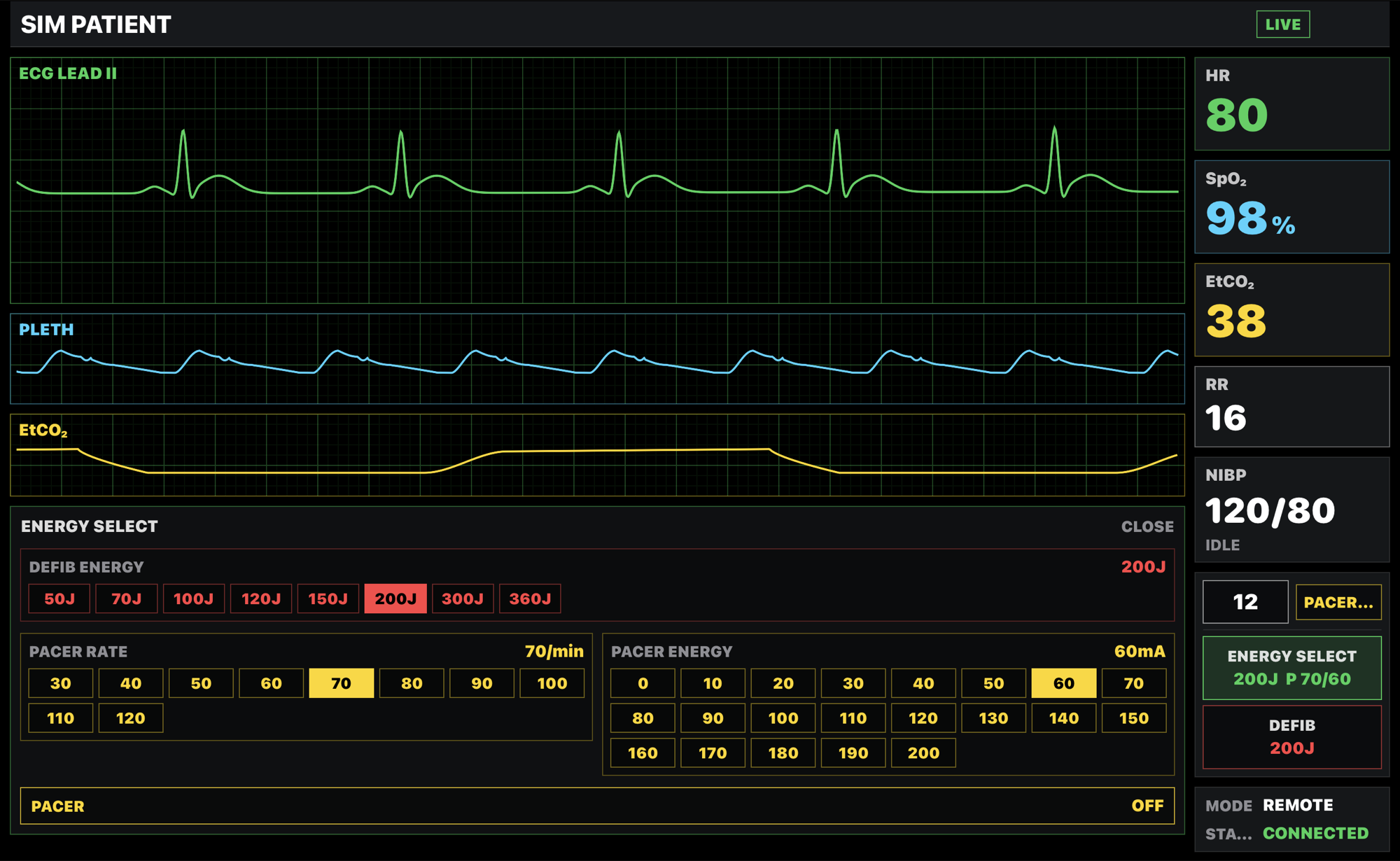 BoxVitals cardiac simulator app monitor view showing ECG waveforms and vital signs