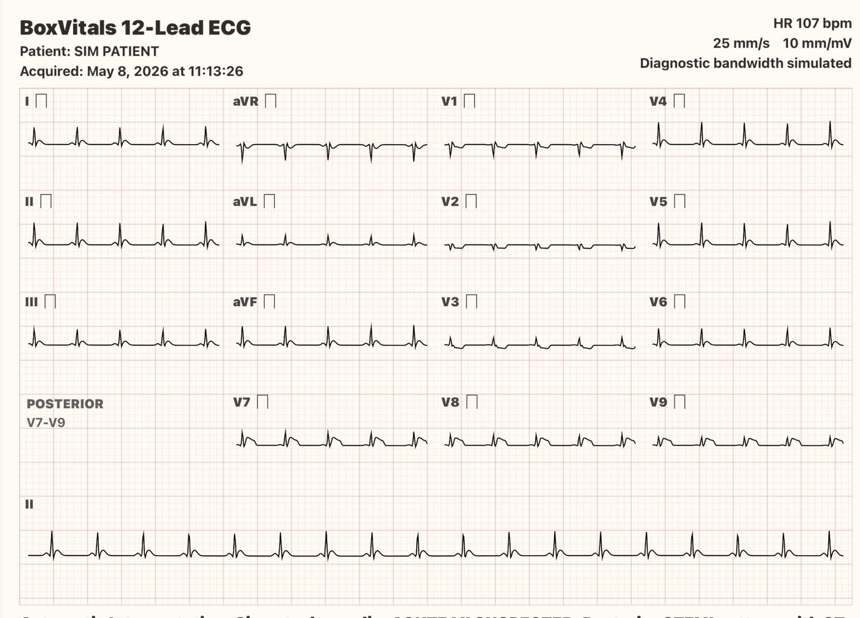 BoxVitals 12-lead ECG simulator screenshot shown during cardiac monitor training