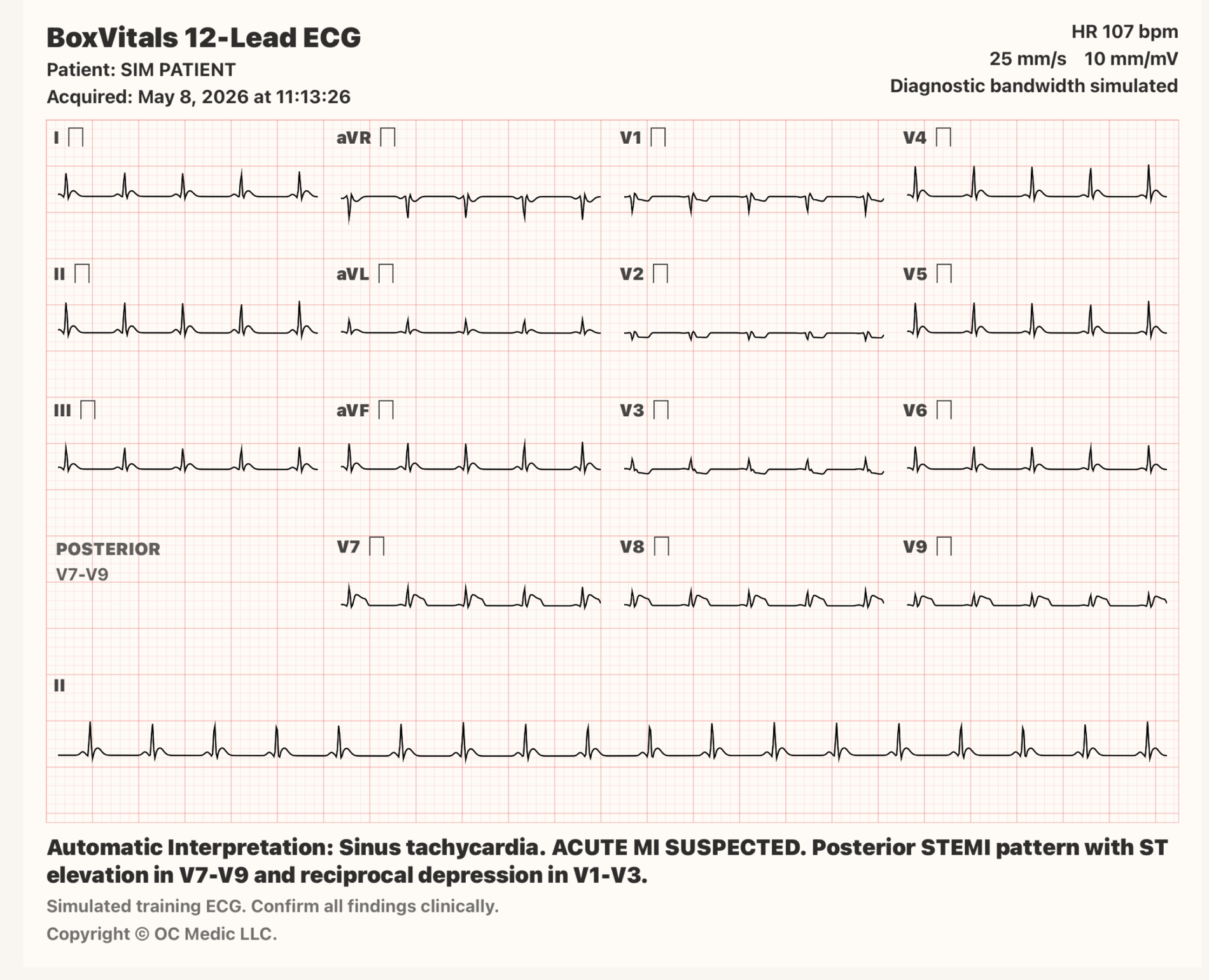 BoxVitals 12-lead ECG simulator showing inferior STEMI with posterior leads V7 through V9